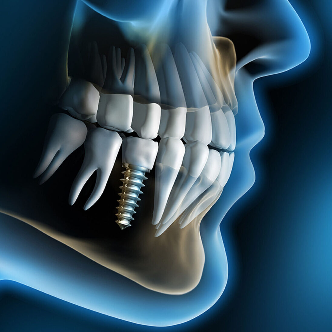 dental wallpaper 566346 eredmeny 1 e1760124533722 4 Dentys Győr – Moderná zubná klinika s odbornou starostlivosťou